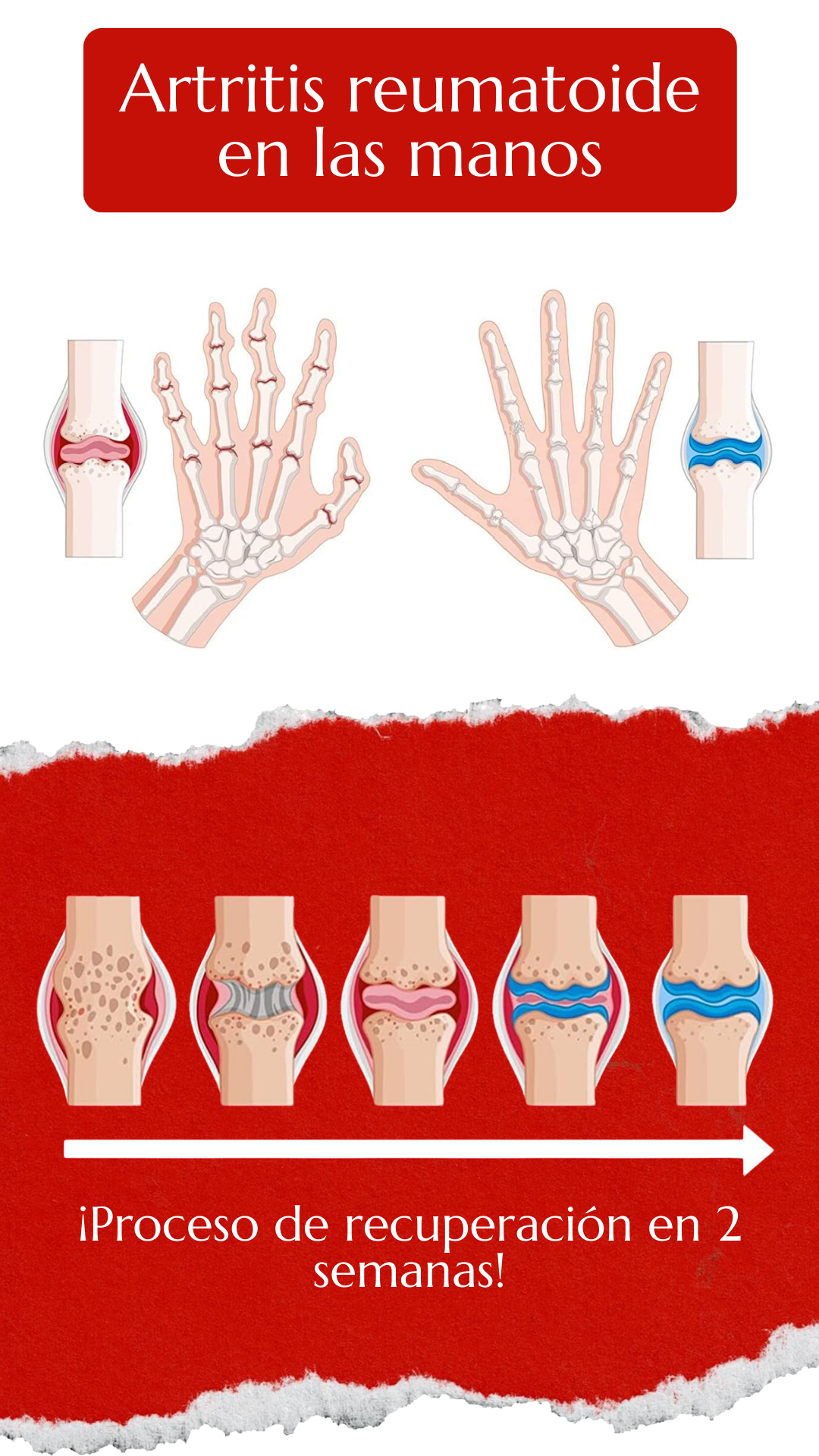 PerfectX™ | Crema Original Americana para Dolores Musculares